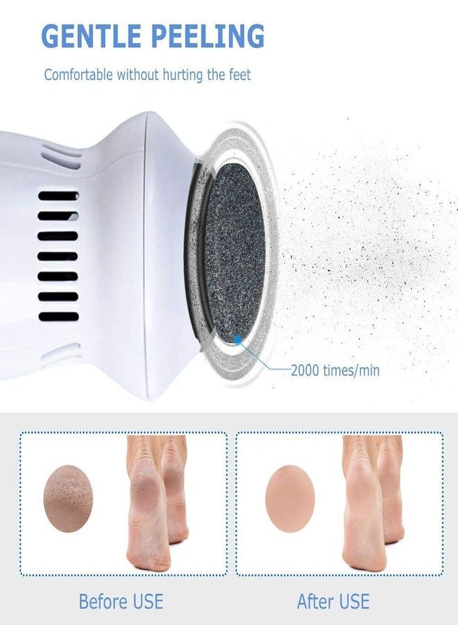 MABRON (FIRST TIME IN INDIA WITH 19 YEARS WARRANTY) New Electical Portable Pedi Foot Cleaner & Callus Remover The Ultimate Solution for Hard, Cracked Skin and Massage_Rg29 - Image 5