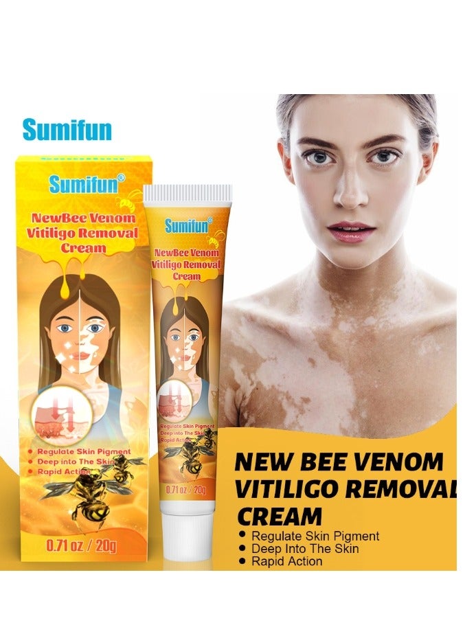 سوميفون كريم تخفيف البهاق من سم النحل 20 جم، علاج لمرهم البهاق للبشرة، تلاشي البقع البيضاء وتحسين كريم تصبغ الجلد، كريم البهاق للعناية الصحية بالبشرة - Image 1
