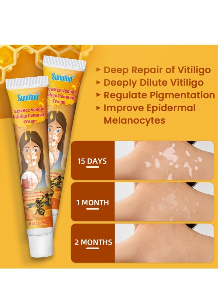 سوميفون كريم تخفيف البهاق من سم النحل 20 جم، علاج لمرهم البهاق للبشرة، تلاشي البقع البيضاء وتحسين كريم تصبغ الجلد، كريم البهاق للعناية الصحية بالبشرة - Image 3