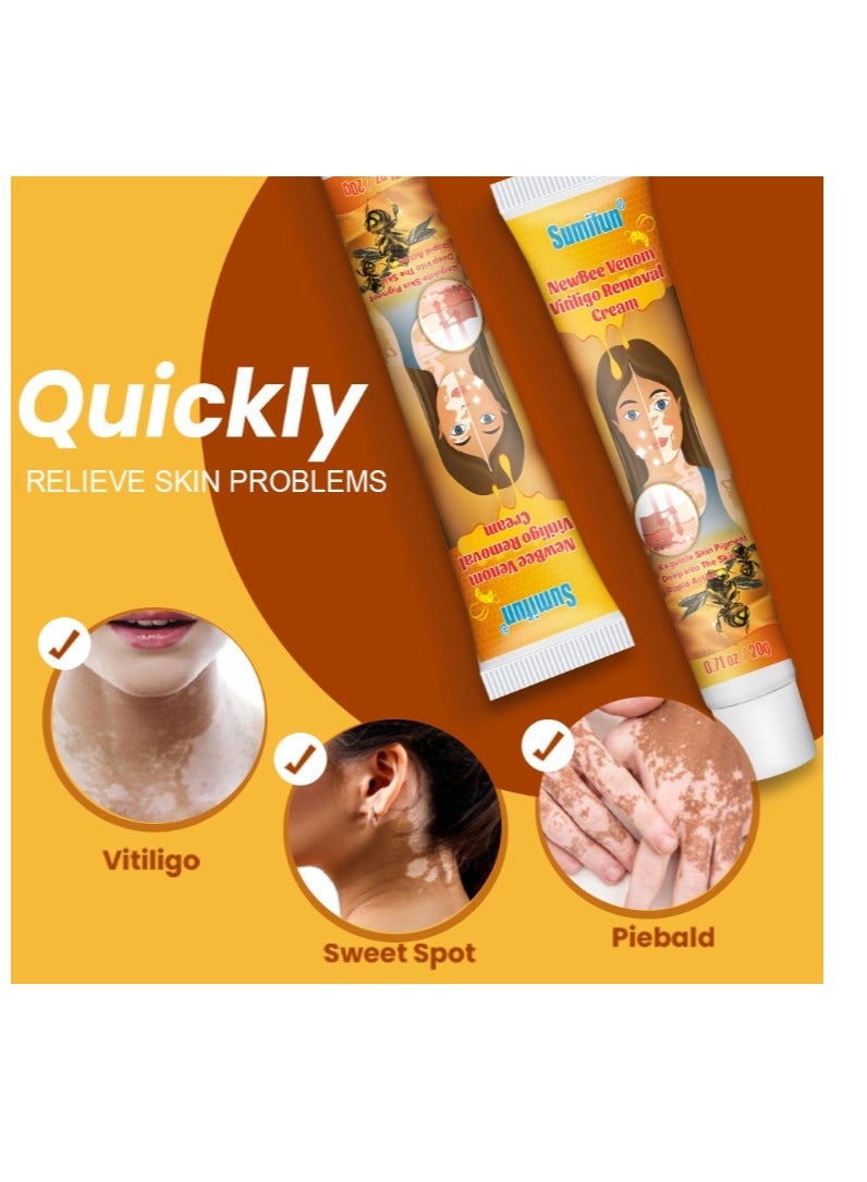 سوميفون كريم تخفيف البهاق من سم النحل 20 جم، علاج لمرهم البهاق للبشرة، تلاشي البقع البيضاء وتحسين كريم تصبغ الجلد، كريم البهاق للعناية الصحية بالبشرة - Image 4