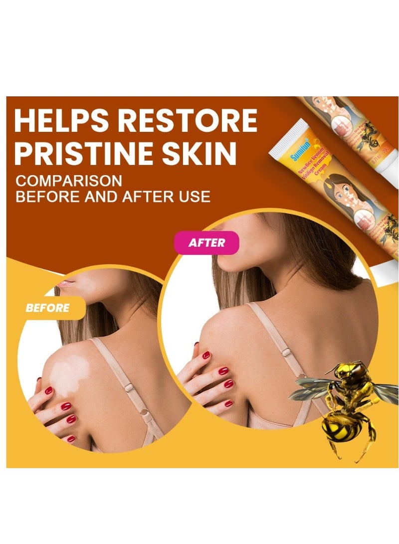 سوميفون كريم تخفيف البهاق من سم النحل 20 جم، علاج لمرهم البهاق للبشرة، تلاشي البقع البيضاء وتحسين كريم تصبغ الجلد، كريم البهاق للعناية الصحية بالبشرة - Image 5