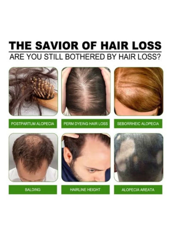 SOUTH MOON Anti-Hair Loss Nourishing Spray Moisturizing Anti-Hair Loss Scalp Care Liquid  - Image 2