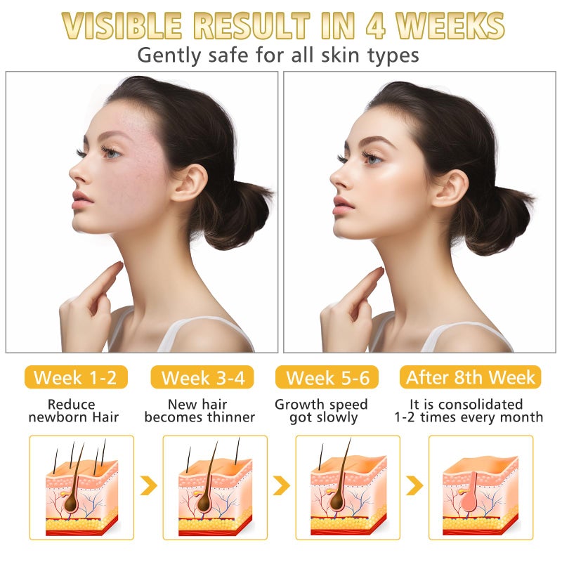 WAYCOM Facial Hair Remover Threading Hair Removal for Women Automatic Threader Machine Epilator for Fine Hairs on Face, Chin, Upper Lip, Arms Birthday Mother's Day Present - Image 2