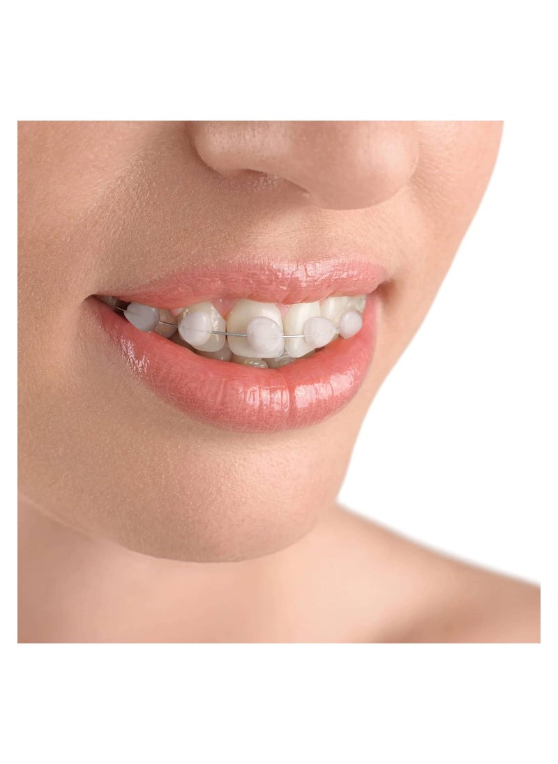 5 Boxes Dental Wax for Braces Dental Special Protective Wax Orthodontic Wax for Orthodontics Braces Wearer for Braces Wearer Aligners Brackets 5 Different Flavours