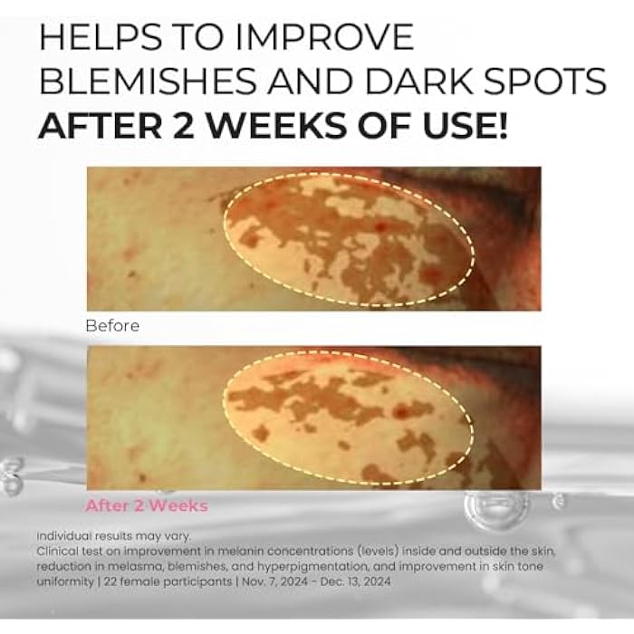 SKIN & LAB SKIN SCIENCE SOLUTION [Skin&LAB] TX Niacin Essence Toner, Brightening & Hydrating Facial Toner with 3% Tranexamic Acid and 5% Niacinamide, Dark Spot Correcting Korean Skincare for Radiant, Even-Toned Skin, 6.76 fl. oz. - Image 4