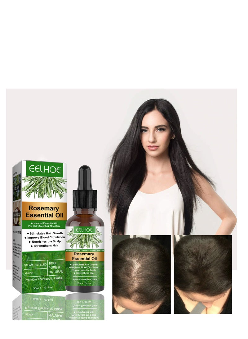 EELHOE 1 pcs Rosemary Hair Growth Essential Oil Prevent Hair Loss Nourish Scalp Strengthen Hair 30ml - Image 2