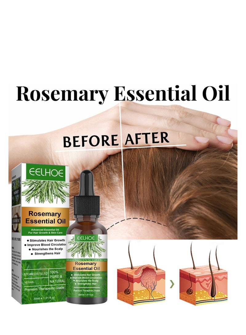 EELHOE 1 pcs Rosemary Hair Growth Essential Oil Prevent Hair Loss Nourish Scalp Strengthen Hair 30ml - Image 3