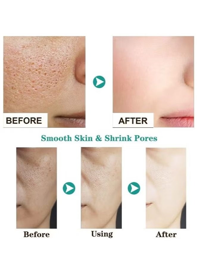 AuQuest Salicylic Acid Acne Face Cream Whitening Facial Treatment Hyaluronic Acid Black Dots Remove Skin Care Beauty Health Repairing Skin Base Essence 15ml - Image 5