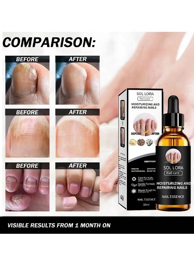 SOL LORA Moisturizing and Repairing Nails - Grey Nail Repair Thicken & Shine Nail Moisturising Solution 30ml - Image 4