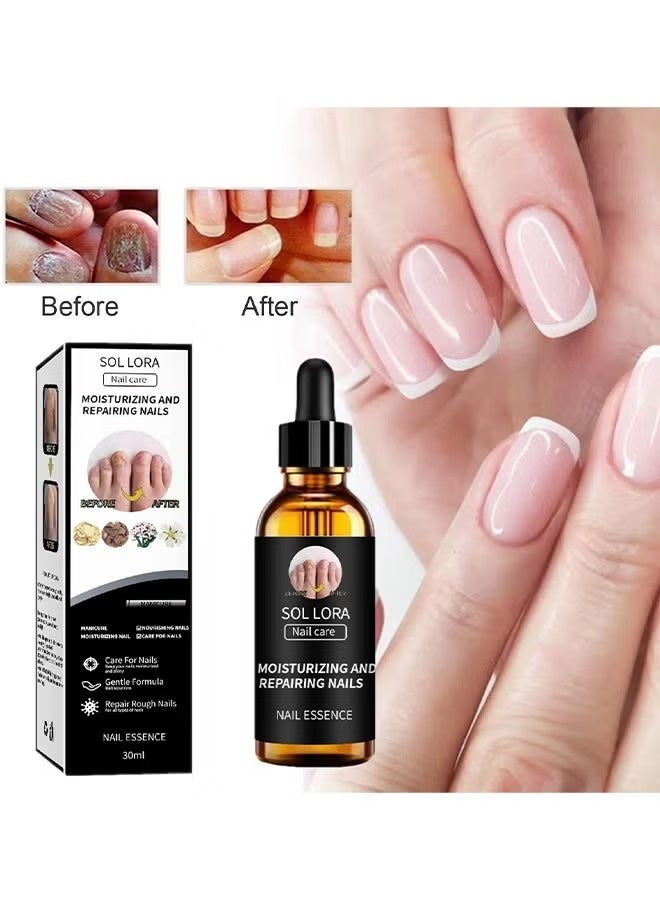 SOL LORA Moisturizing and Repairing Nails - Grey Nail Repair Thicken & Shine Nail Moisturising Solution 30ml - Image 1