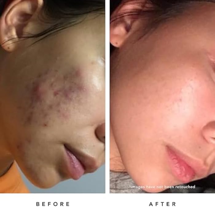 HERBIVORE Blue Tansy BHA & Enzyme Pore Refining Mask - Naturally Clarifies Acne, Blemishes & Redness, Vegan & Cruelty-Free, 60 mL / 2.02 oz - Image 4