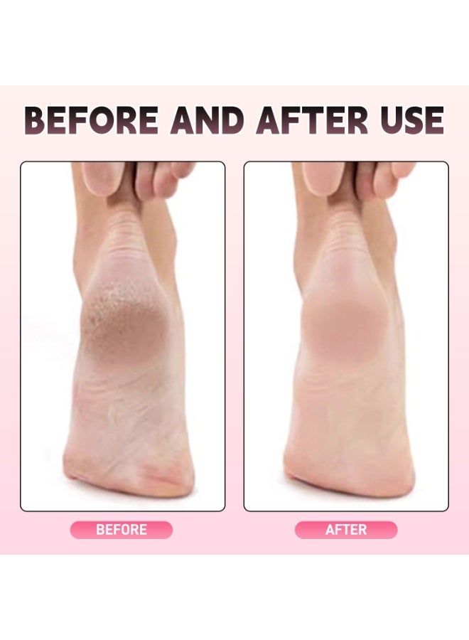 Dovva 2-in-1 Electric Callus Remover for Feet & Hands, Professional 600RPM Aluminum 12cm Foot File with Stepless Speed Control, w/80 Replaceable Sandpaper Discs (4 Sizes) for Dead Skin Removal - Image 5