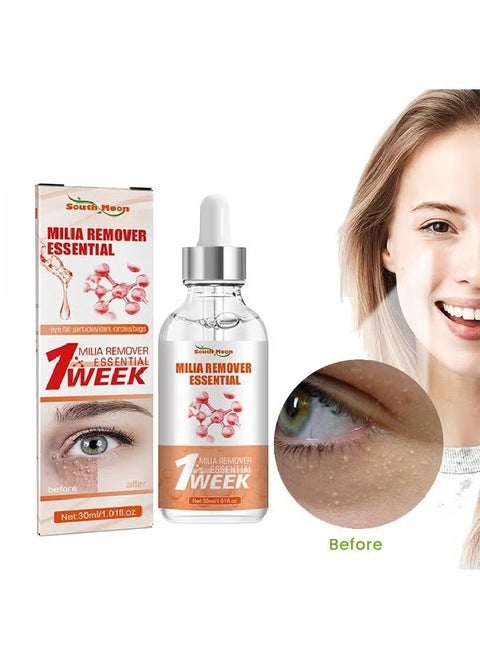 Milia Removal Essential, Milia Spot Treatment Helps Dissolve And Reduce Milia, Whitehead And Sebaceous Hyperplasia 30 ML