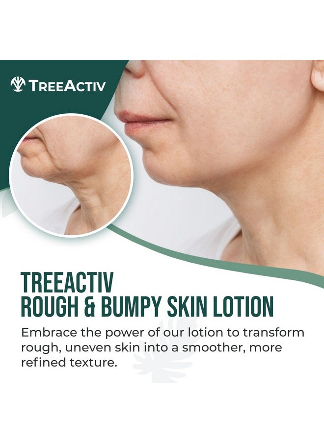 TreeActiv Rough And Bumpy Skin Lotion 8 Fl Oz With Hyaluronic Acid Shea Butter And Vitamin E Nourishing Lotion For Rough And Bumpy Skin Moisturizing Strawberry Legs Treatment For All Skin Types  - Image 2
