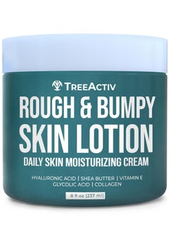 TreeActiv Rough And Bumpy Skin Lotion 8 Fl Oz With Hyaluronic Acid Shea Butter And Vitamin E Nourishing Lotion For Rough And Bumpy Skin Moisturizing Strawberry Legs Treatment For All Skin Types  - Image 1