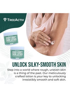 TreeActiv Rough And Bumpy Skin Lotion 8 Fl Oz With Hyaluronic Acid Shea Butter And Vitamin E Nourishing Lotion For Rough And Bumpy Skin Moisturizing Strawberry Legs Treatment For All Skin Types  - Image 3
