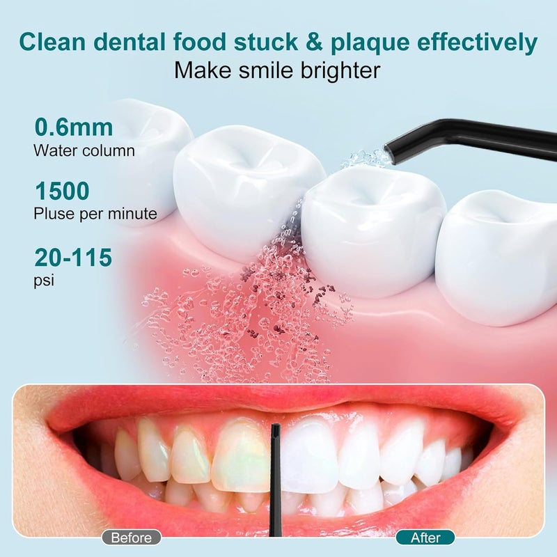 Nicefeel Cordless Water Dental Flosser – 300ML BPA-Free Portable Oral Irrigator, 3 Cleaning Modes, Fast Charge, IPX7 Waterproof for Teeth, Gums & Tonsil Stones – Home & Travel Use - Image 2