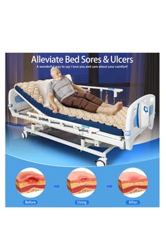 Cool Baby COOLBABY Silent Alternating Air Pressure Mattress With Mattress Cover And Pump Inflatable Silent Mattress To Prevent Bedsores And Sore Treatment For Bedridden Patients  - Image 3