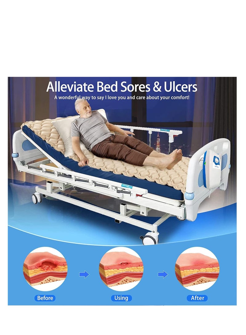 Cool Baby COOLBABY Silent Alternating Air Pressure Mattress With Mattress Cover And Pump Inflatable Silent Mattress To Prevent Bedsores And Sore Treatment For Bedridden Patients - Image 3