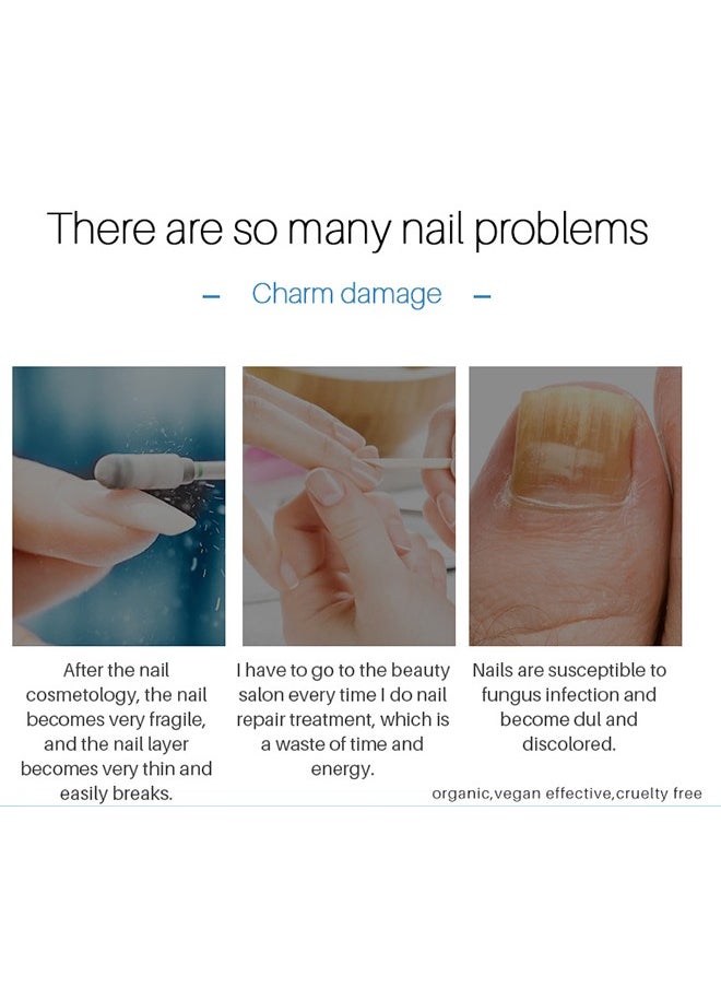 Lanthome Nail Repair，Extra Strong Nail & Toe Fungus Treatment Pen Best Nail Repair Set Fungi Fingernail & Toenail Solution Fix & Renew Damage Fungal Nail Broken Cracked & Discolored Nails  - Image 2