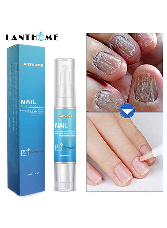 Lanthome Nail Repair，Extra Strong Nail & Toe Fungus Treatment Pen Best Nail Repair Set Fungi Fingernail & Toenail Solution Fix & Renew Damage Fungal Nail Broken Cracked & Discolored Nails - Image 1