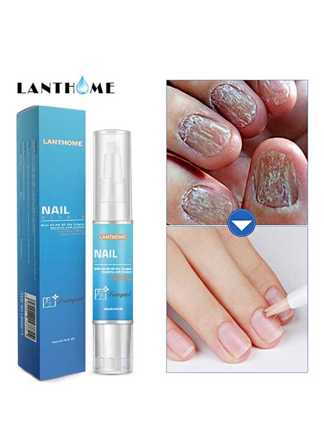 Lanthome Nail Repair，Extra Strong Nail & Toe Fungus Treatment Pen Best Nail Repair Set Fungi Fingernail & Toenail Solution Fix & Renew Damage Fungal Nail Broken Cracked & Discolored Nails  - Image 1