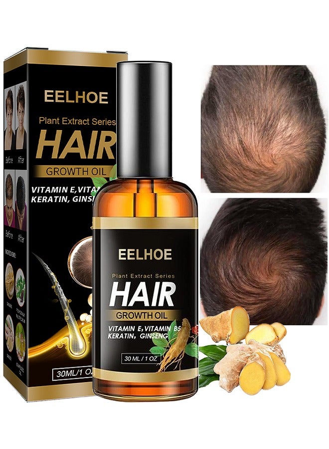 EELHOE Plant Extract Hair Growth Oil, Ginger Essential Oil Hair Growth, For Hair Loss, Hair Grow Thicker And Longer, Fast Hair Growth - Image 1