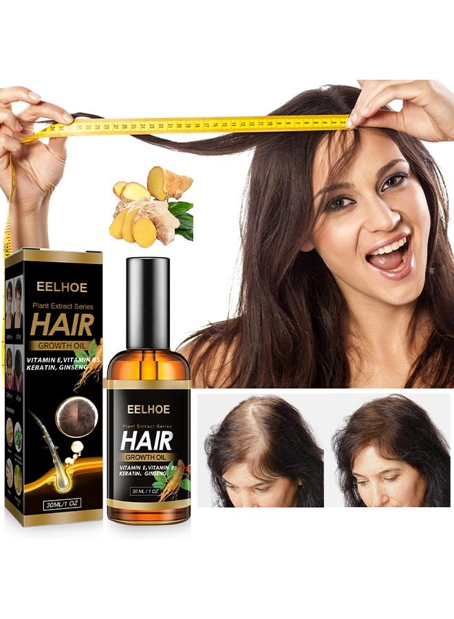 EELHOE Plant Extract Hair Growth Oil, Ginger Essential Oil Hair Growth, For Hair Loss, Hair Grow Thicker And Longer, Fast Hair Growth - Image 2