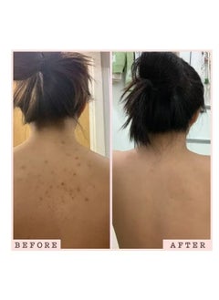 CLENZ Original Sudanese Dalka Natural, Unique Skin Moisturizing and Exfoliating Recipe -250 g  - Image 2
