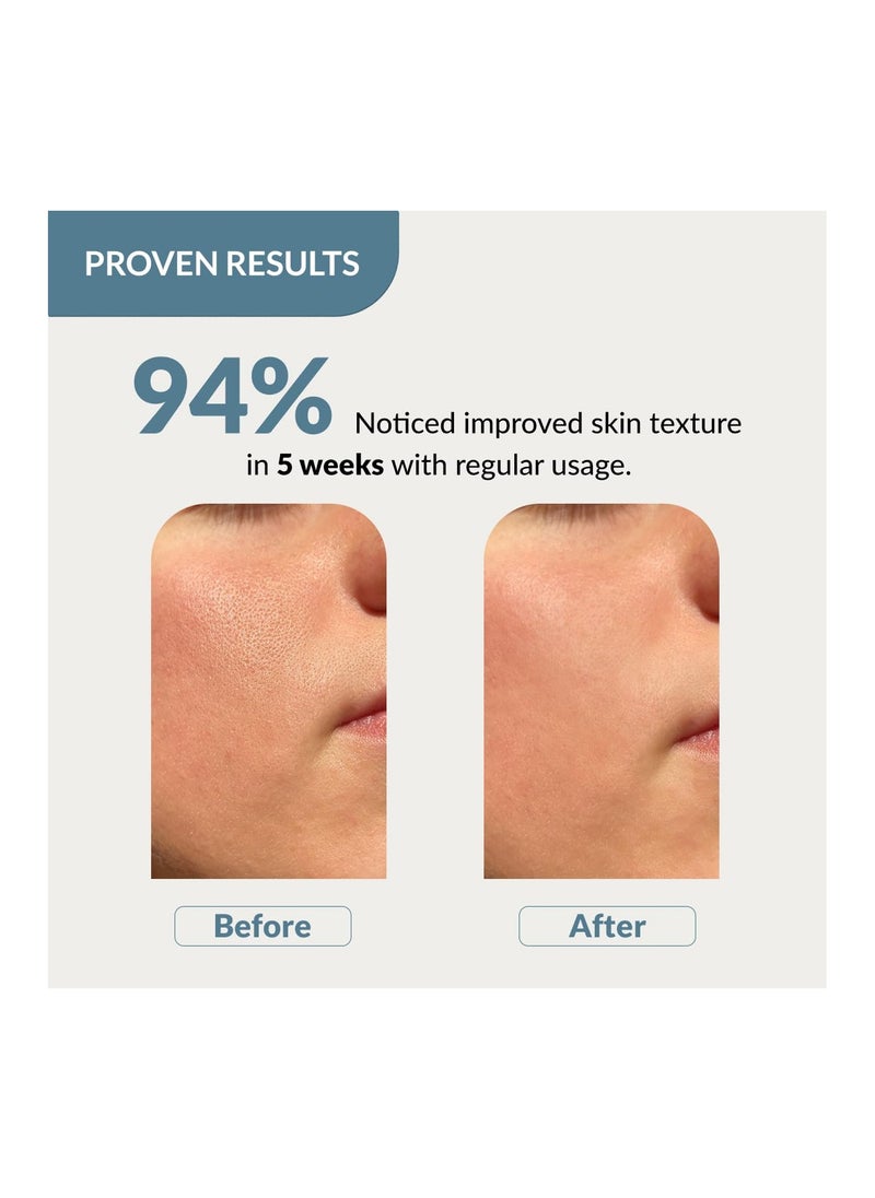 FIXDERMA Fixderma 20% Niacinamide Serum for Face for Pore Minimizer with 2.5% Glucosamine & Hyaluronic Acid Serum | Open Pores Serum | Hydrating Serum | Face Serum for Men & Women - 30g  - Image 2