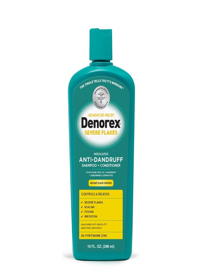 Denorex Advanced Relief Severe Flakes Anti-Dandruff 2-in-1 Shampoo & Conditioner | 2% Pyrithione Zinc | Severe Dandruff & Scalp Relief | 2x Flake-Fighting Power vs. Leading Dandruff Shampoos 10 fl oz - Image 1
