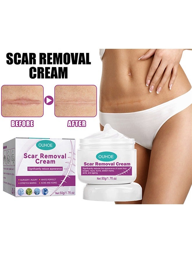 أوهو كريم إزالة الندبات - للتخلص من الجلد الميت للجلد التالف كريم إزالة الندوب الجديدة والقديمة مستخلصات عشبية حقن الحروق إصلاح بشرة الوجه والجسم للجنسين 50 جرام - Image 1
