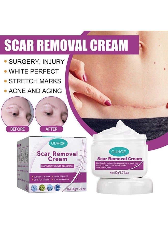 أوهو كريم إزالة الندبات - للتخلص من الجلد الميت للجلد التالف كريم إزالة الندوب الجديدة والقديمة مستخلصات عشبية حقن الحروق إصلاح بشرة الوجه والجسم للجنسين 50 جرام - Image 2
