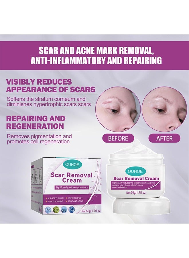 أوهو كريم إزالة الندبات - للتخلص من الجلد الميت للجلد التالف كريم إزالة الندوب الجديدة والقديمة مستخلصات عشبية حقن الحروق إصلاح بشرة الوجه والجسم للجنسين 50 جرام - Image 3