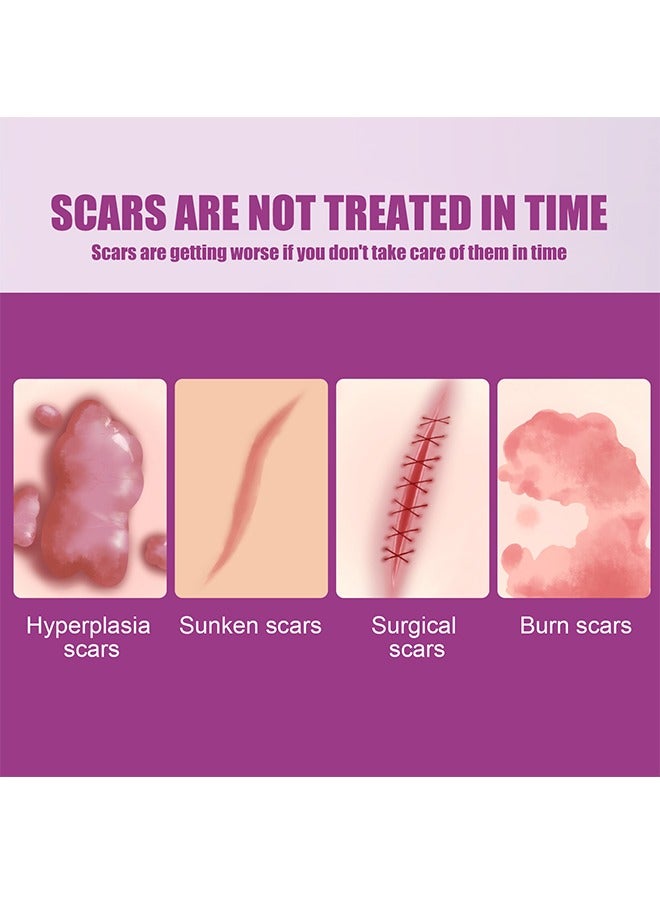 أوهو كريم إزالة الندبات - للتخلص من الجلد الميت للجلد التالف كريم إزالة الندوب الجديدة والقديمة مستخلصات عشبية حقن الحروق إصلاح بشرة الوجه والجسم للجنسين 50 جرام - Image 4