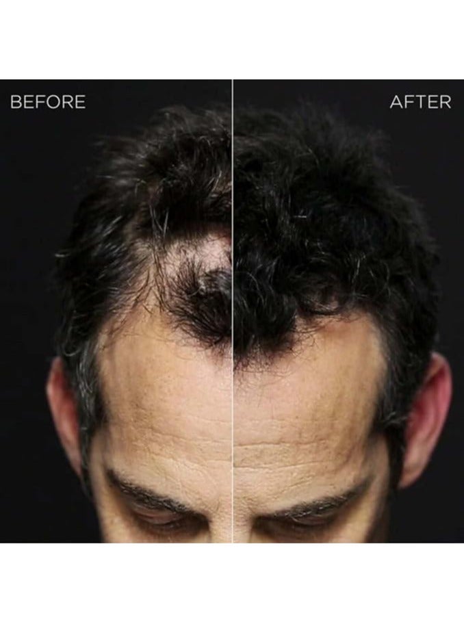 Toppik Hair Building Fibers Black Color - Image 5