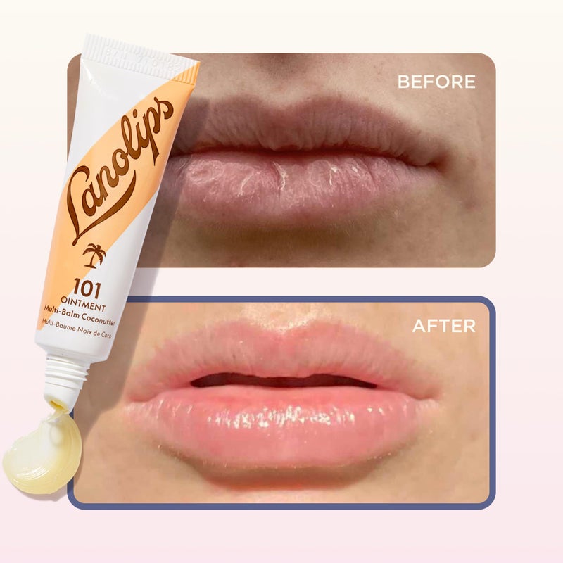 Lanolips 101 Ointment - Lanolin Lip Balm for Smooth, Hydrated & Healthy Lips - Multipurpose Lip Ointment with Lanolin Oil for Dry Lips, Cuticles & More - Coconutter (0.35 oz) - Image 5