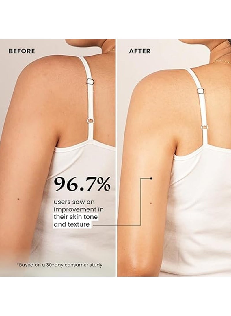 foxtale Spf 30 Detan Brightening Body Lotion With Niacinamide & Vitamin C For Glowing Skin|Lightweight & Non-Sticky|Floral Fragrance|Body Lotion For Men & Women|All Skin Type|200 Ml - Image 2