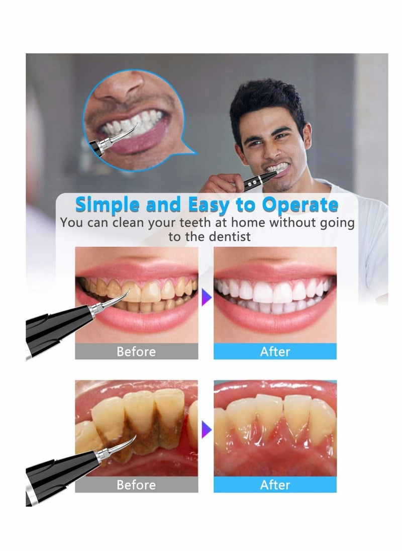 Ultrasonic Tooth Cleaner Plaque Remover for Teeth Remove Teeth Stain tarter Plaque Calculus  with Led 5 Adjustable Modes 2 Replaceable Clean Heads Safe