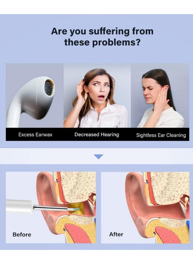 إزالة شمع الأذن - مجموعة أدوات إزالة شمع الأذن من 9 قطع - منظف قناة الأذن مع كاميرا بدقة 1080 بكسل، مزيل شمع الأذن مع رؤوس استبدال متعددة، لون أبيض - Image 3