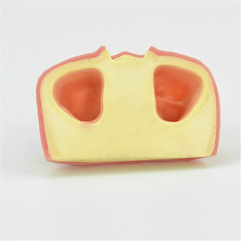 Maxillary Dental Implant Model - Simulation Model of Maxillary Sinus Lift Implant Practice - Study Model Dental Adult Teeth Model Maxillary Miss Teeth Teaching Model - Image 5