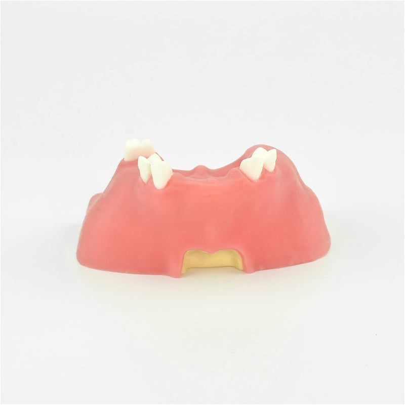 Maxillary Dental Implant Model - Simulation Model of Maxillary Sinus Lift Implant Practice - Study Model Dental Adult Teeth Model Maxillary Miss Teeth Teaching Model - Image 2
