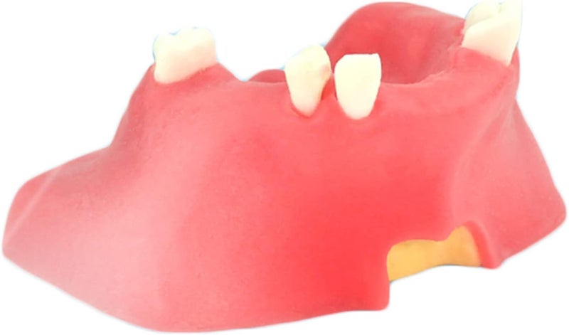 Maxillary Dental Implant Model - Simulation Model of Maxillary Sinus Lift Implant Practice - Study Model Dental Adult Teeth Model Maxillary Miss Teeth Teaching Model - Image 1