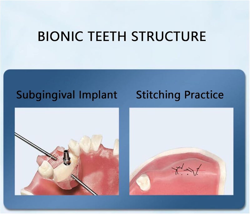 Maxillary Dental Implant Model - Simulation Model of Maxillary Sinus Lift Implant Practice - Study Model Dental Adult Teeth Model Maxillary Miss Teeth Teaching Model - Image 4