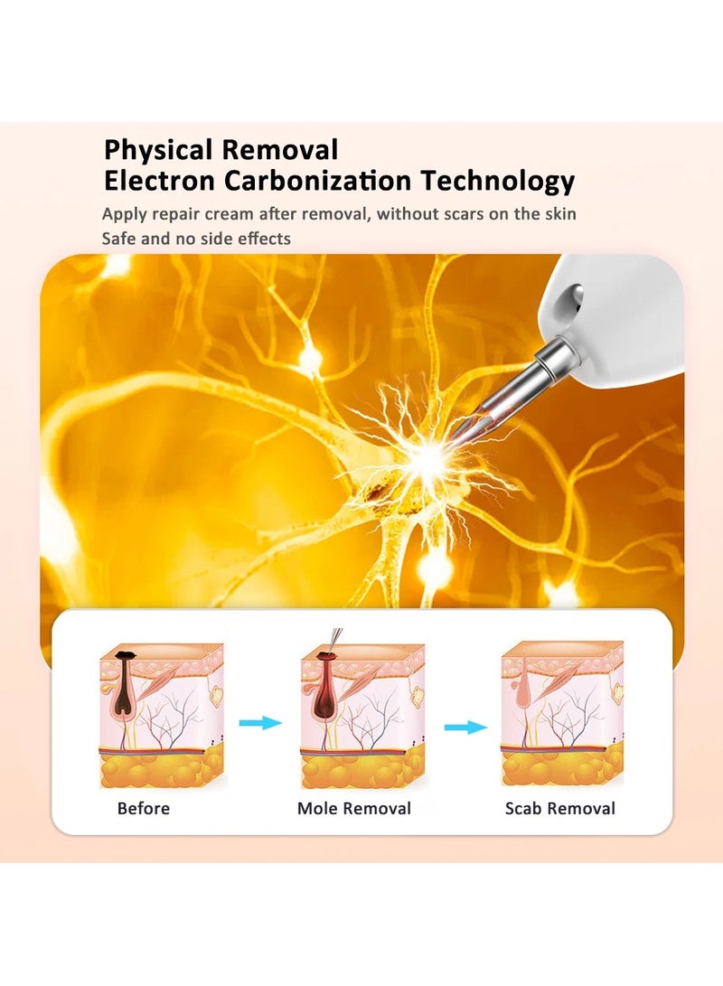 general Laser plasma pen skin tag remover mole wart remover mole blackhead removal face body mole removal pen - Image 4