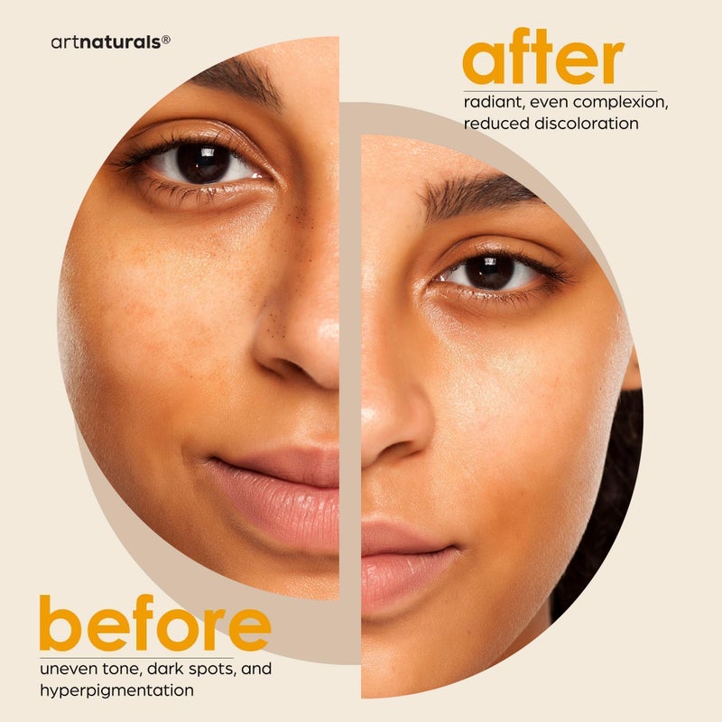 artnaturals صابون حمض الكوجيك + إسفنجة شبكية أفريقية (عبوة من قطعتين × 142 جرام من قضبان الكركم) مزيل للبقع الداكنة وفرط التصبغ والندبات - مركب ياباني أصلي فيتامين سي وحمض الهيالورونيك والريتينول وزبدة الشيا (حمضيات) - Image 4