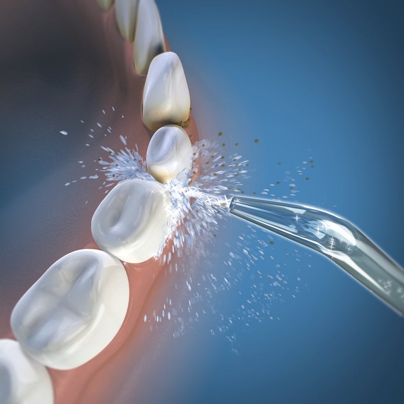 Waterpik Whitening Water Flosser Replacement Tip, Classic Jet, White and Black, 2 Count - Image 3