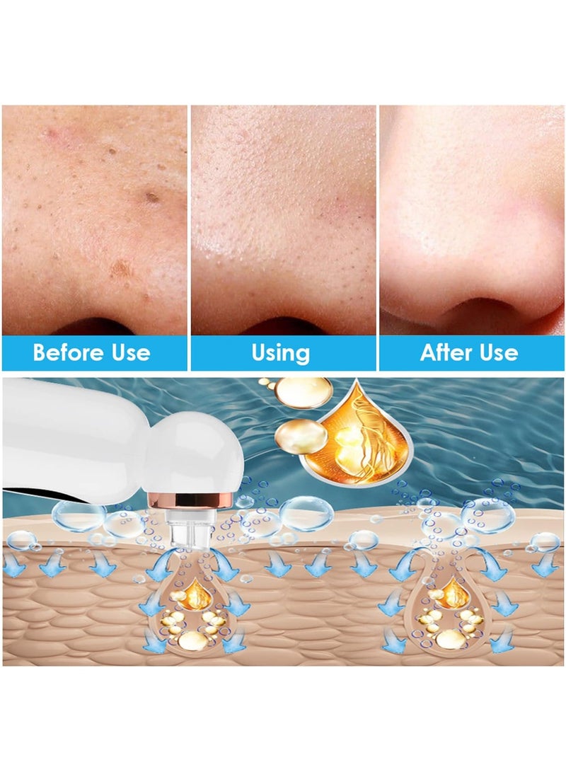 Electric Facial Cleanser with Water Cycle System for Deep Cleansing & Blackhead Removal, Portable Rechargeable Face Cleaning Device for Pore Care, Gentle Exfoliation & Skin Refreshing, Suitable for All Skin Types, White - Image 4