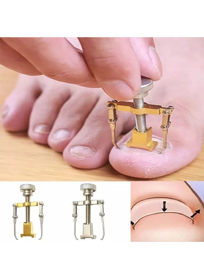 جهاز تصحيح الأظافر الغارزة - أداة علاجية احترافية للتخلص من آلام الأظافر الملتهبة - من الفولاذ المقاوم للصدأ - قابل لإعادة الاستخدام. - Image 4
