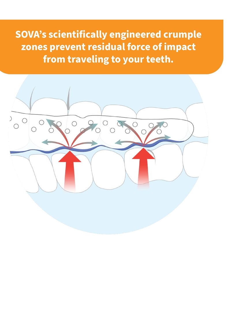 Sova SOVA Junior Night Guard, Purple Punch - 1.6mm Thin - Custom-Molded Fit - Protects Against Nighttime Teeth Grinding & Clenching - Odor & Taste Free - Remoldable Up to 20 Times - Non Toxic - Image 2